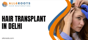 Hair Transplant Near Nehru Place, Delhi: Discreet Care That Fits Your Work - Alloroots Hair Transplant Clinic - India's Best Hair Transplant Services
